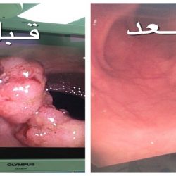 طالب سعودي يتوصل للكشف عن الأمراض الوراثية دون الحاجة لزيارة الطبيب