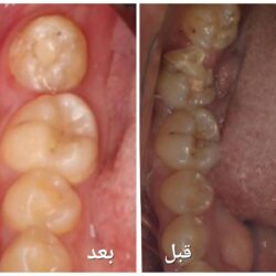 “التعاون الإسلامي” تُدين التفجير الانتحاري قرب الخارجية الأفغانية