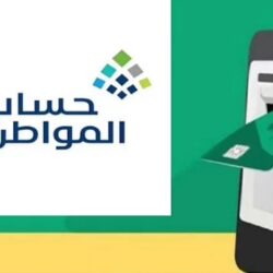 «فهد الطبية» توضح أسباب وأعراض الشقيقة وعلاجها