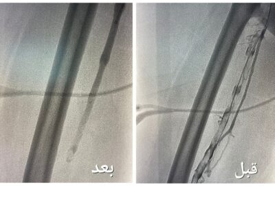 “الصحة” : مجمع الملك عبدالله الطبي في جدة يُعيد الحركة لحاجّة