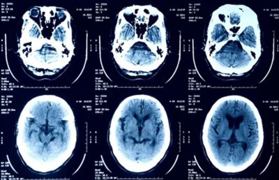 تقرير تقني يحذّر.. لا تحمّل صور أشعتك الطبية إلى روبوتات الدردشة بالذكاء الاصطناعي